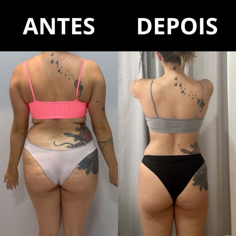 antes e depois 2