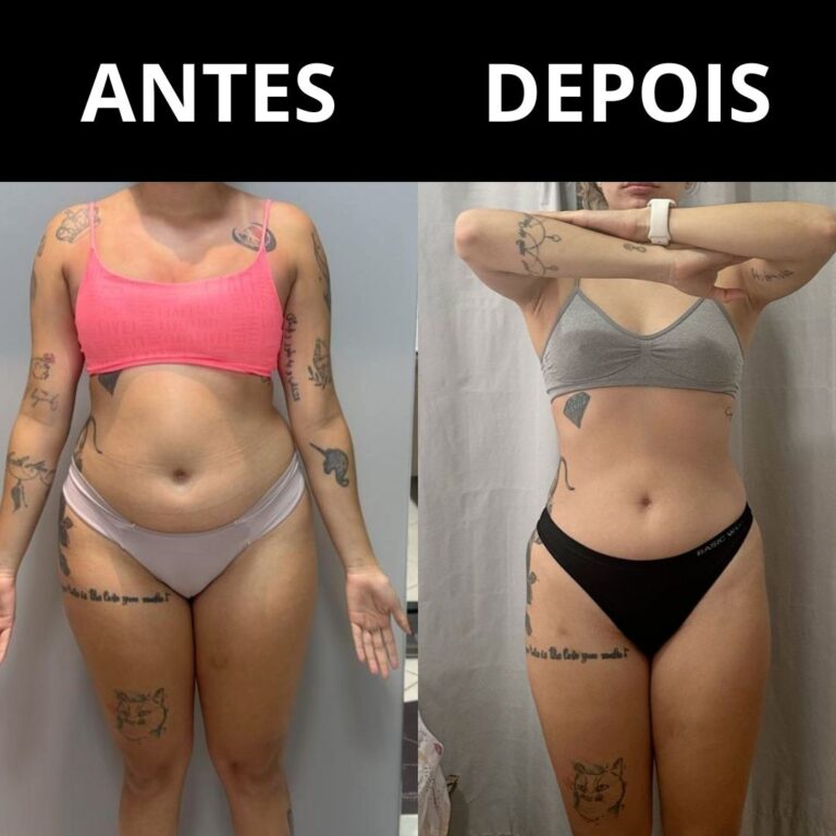 antes e depois 3